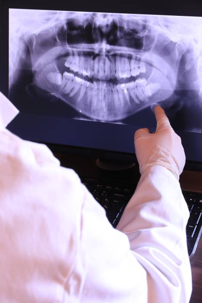 Best Emergency Treatment for Dental Infections or Abscesses in Wiggins, CO